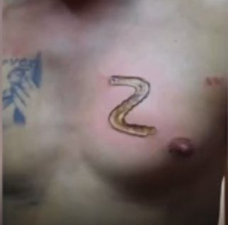 Supporter of Putin inking the "Z" symbol on his chest with a red hot poker